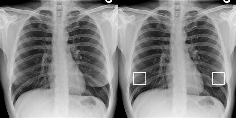 radiographic testing visualize soft tissues|soft tissue radiography .